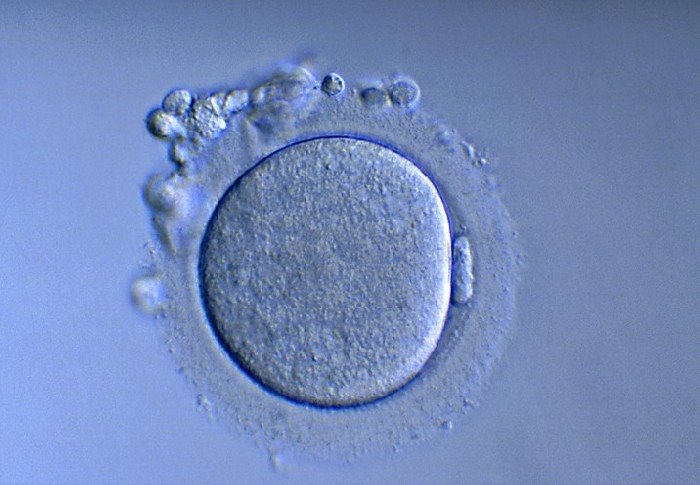 La maturation In Vitro d'ovocytes immatures donne naissance à ses premiers bébé !